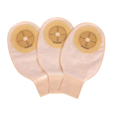 Kantong Ostomi Buka Kantong Clamp Penutupan Drainable 15-60mm Beige